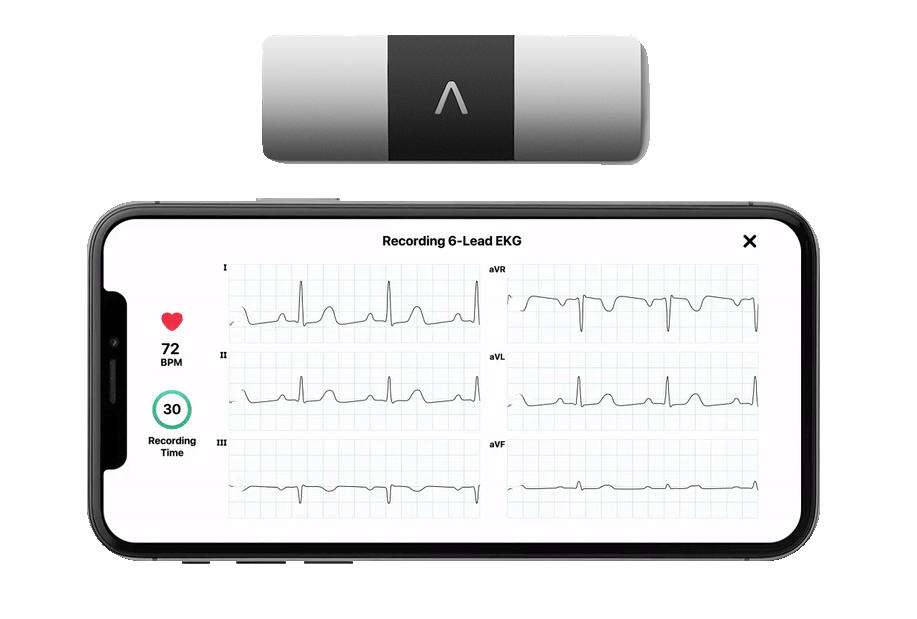 KardiaMobile 6L Recording EKG