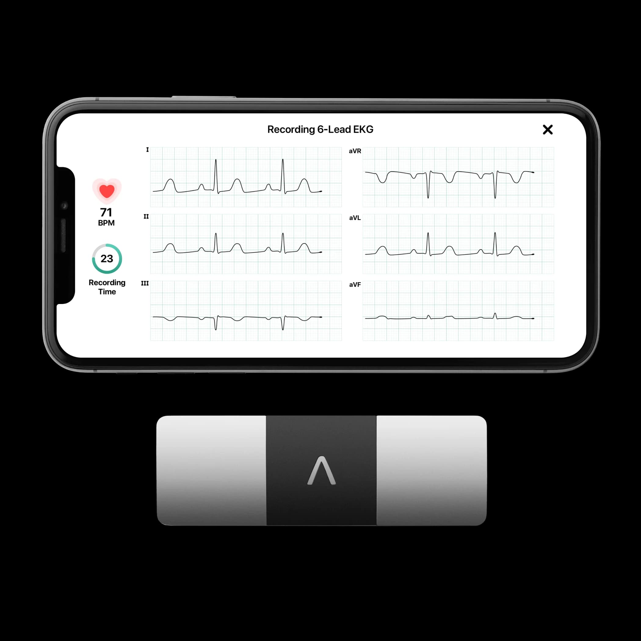 Record an EKG in seconds