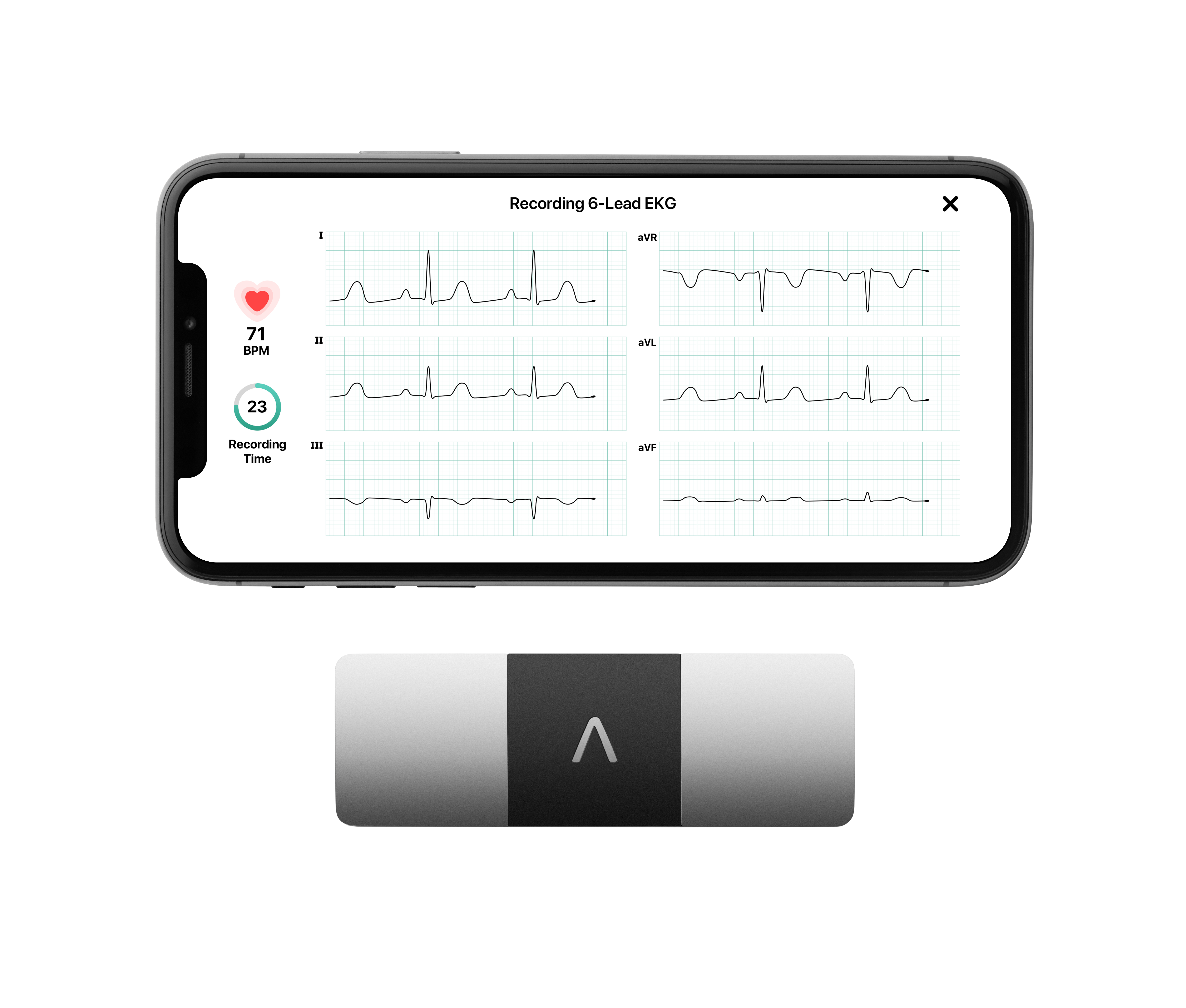 Kardia Device